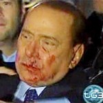 Berlusconi-agredido