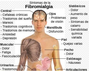 Fibromialgia-hombre