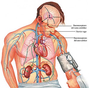 hipertensión-esquema