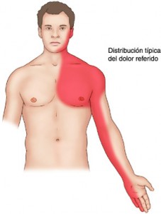 angina-de-pecho