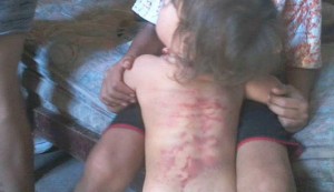 niño-agredido-01