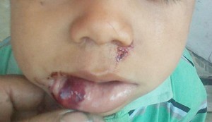 niño-agredido-02