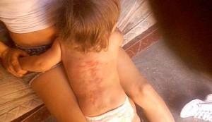 niño-agredido-03
