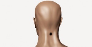 punto-cuello-hielo