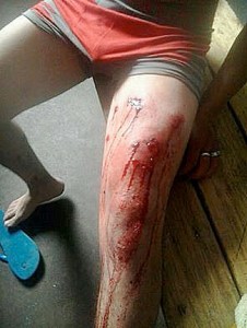 preso-herido-en-Magdalena