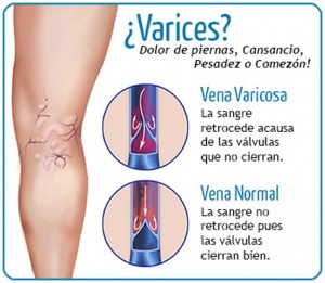 varices_ok
